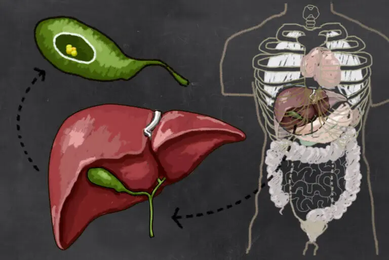 Obstrucción en las vías biliares: todo lo que debes saber