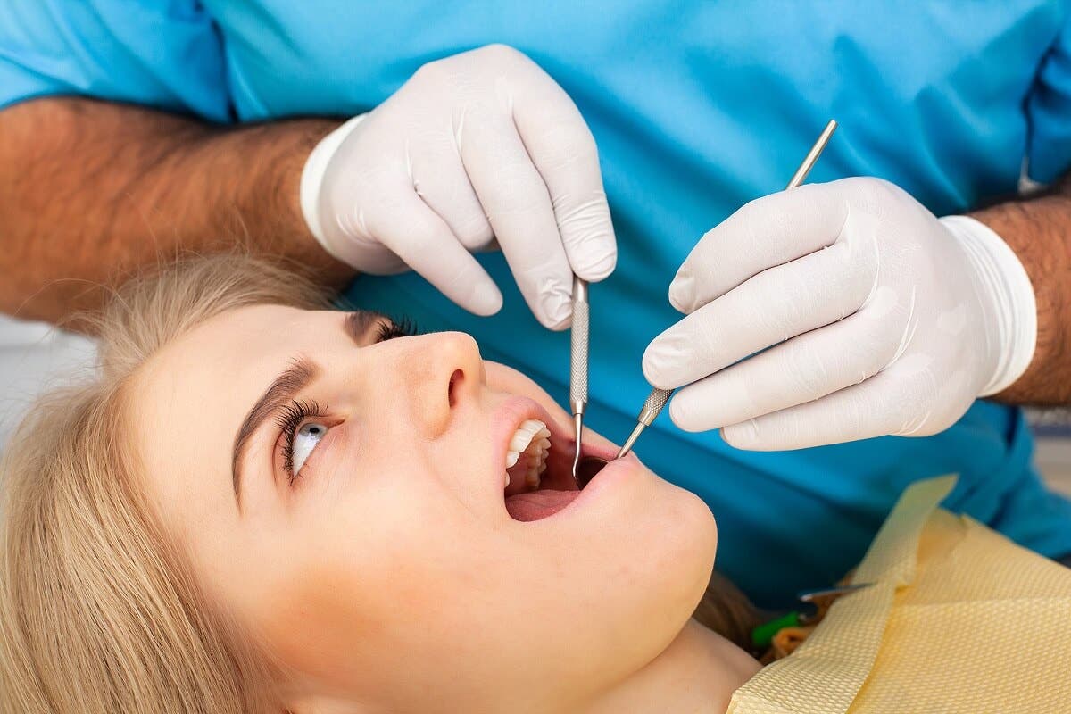 Extracción dental que lleva a alveolitis seca.