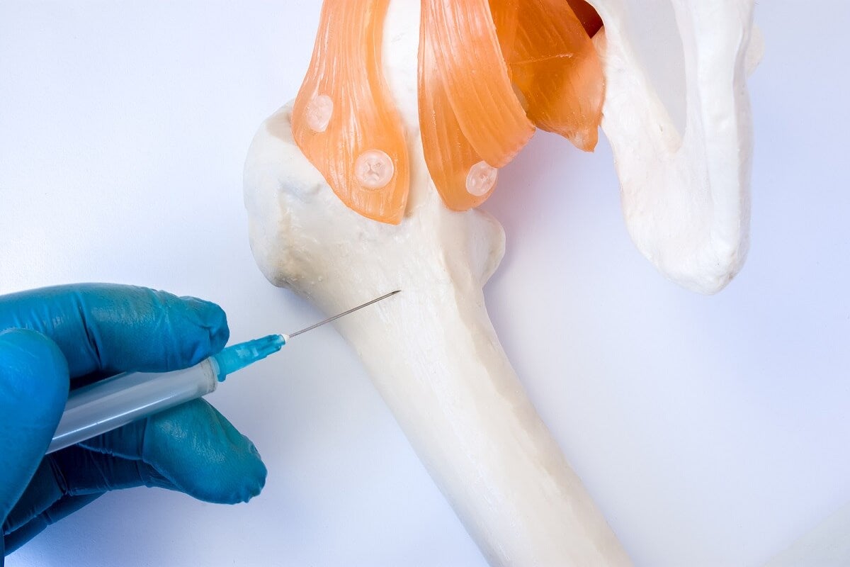 Aspiración y biopsia de médula ósea: ¿en qué consiste?