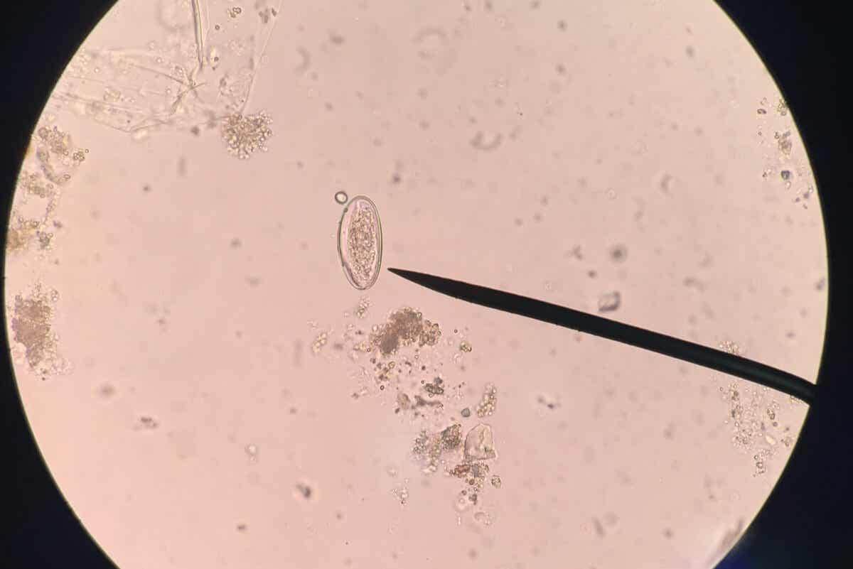 Huevo de enterobius al microscopio.