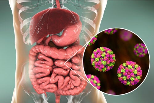 Infección por norovirus: síntomas, causas y tratamientos