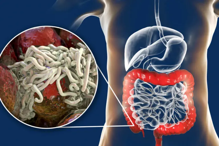 Infección por oxiuros: todo lo que debes saber