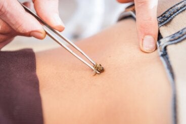 Apiterapia o terapia con abejas: ¿qué es y para qué se usa?