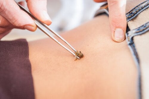 Apiterapia o terapia con abejas: ¿qué es y para qué se usa?