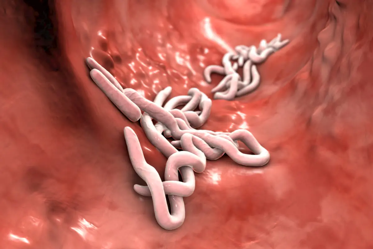 Parásitos intestinales en una infección por oxiuros.