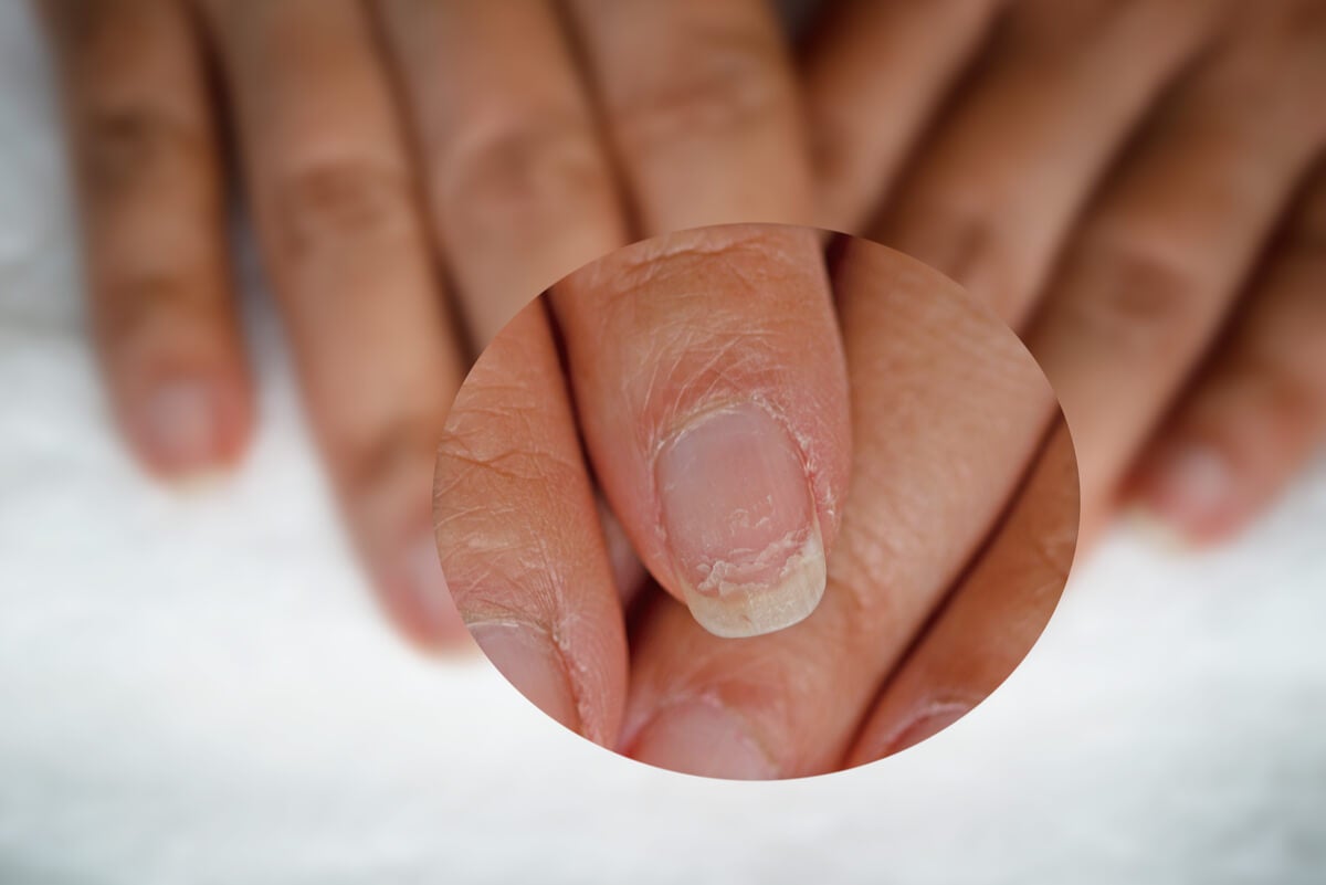 Cómo quitar pegamento instantáneo de la piel: 8 Pasos
