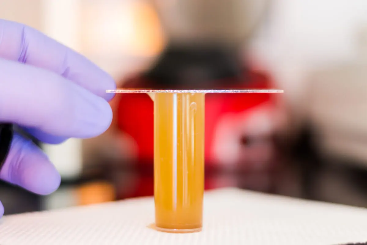 Examen de materia fecal para estrngiloidiasis.