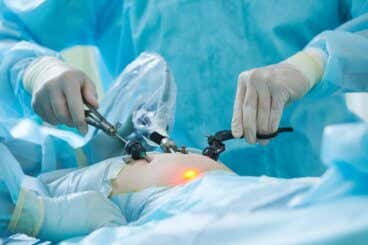 ¿Qué es una laparoscopia?