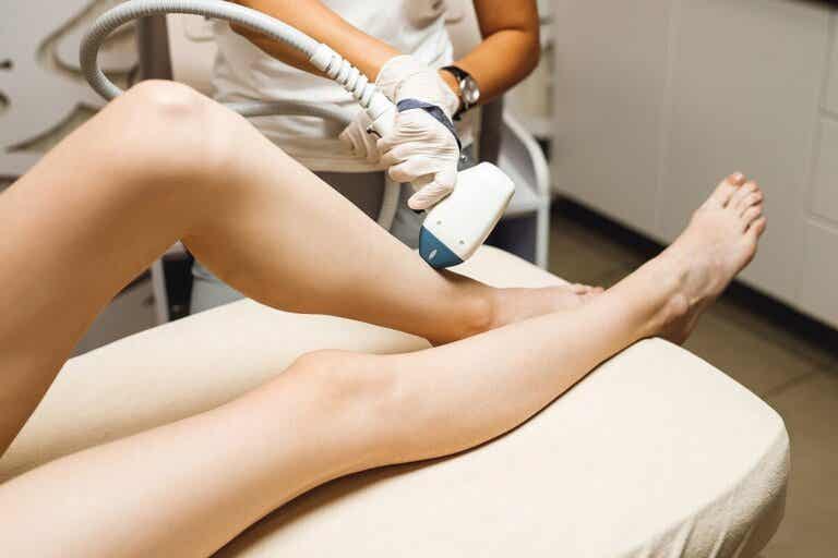 ¿Cómo funciona la depilación láser y qué efectos tiene sobre la piel?