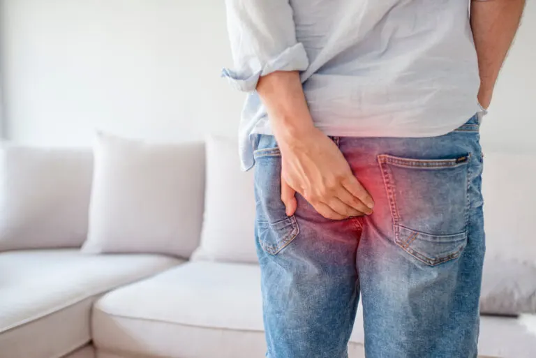 ¿Qué es y cómo identificar las hemorroides trombosadas?