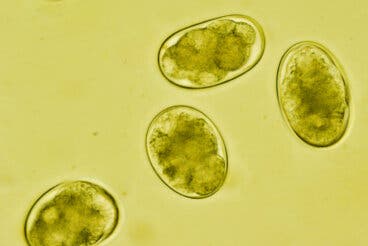 ¿Qué es la estrongiloidiasis y cómo se contagia?