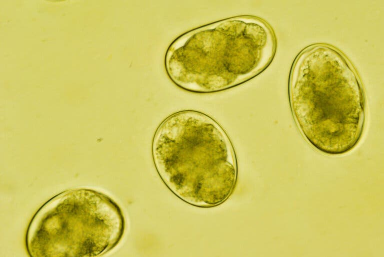 ¿Qué es la estrongiloidiasis y cómo se contagia?