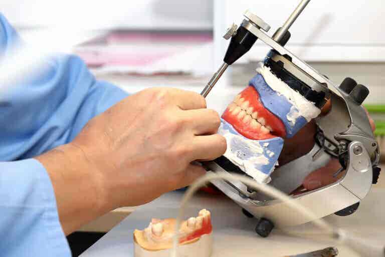 Prótesis sobre implantes dentales: ¿qué son y qué tipos existen?