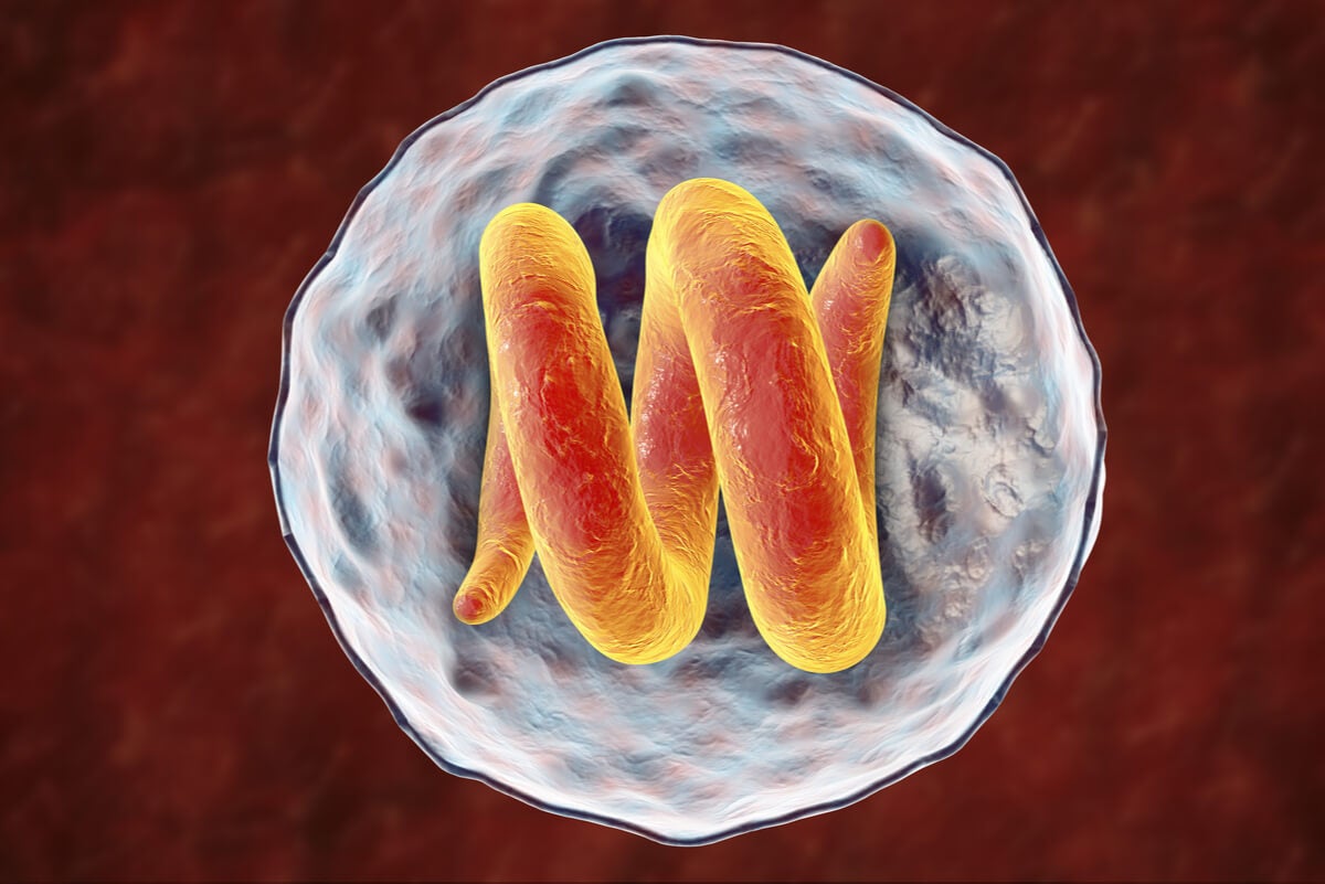 Qué es la triquinosis y cómo afecta al organismo? - Mejor con Salud