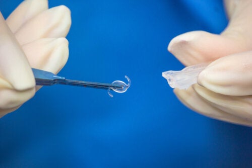 Cirugía de lente intraocular: ¿cuándo es necesaria?