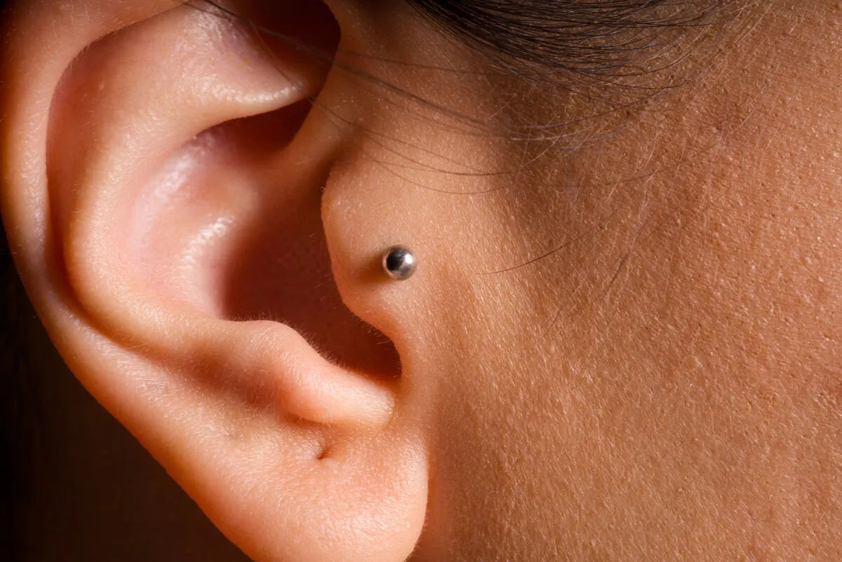 Piercing con níquel que causa alergia.