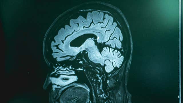 Klonus Was ist das und welche Ursachen hat er? Besser Gesund Leben