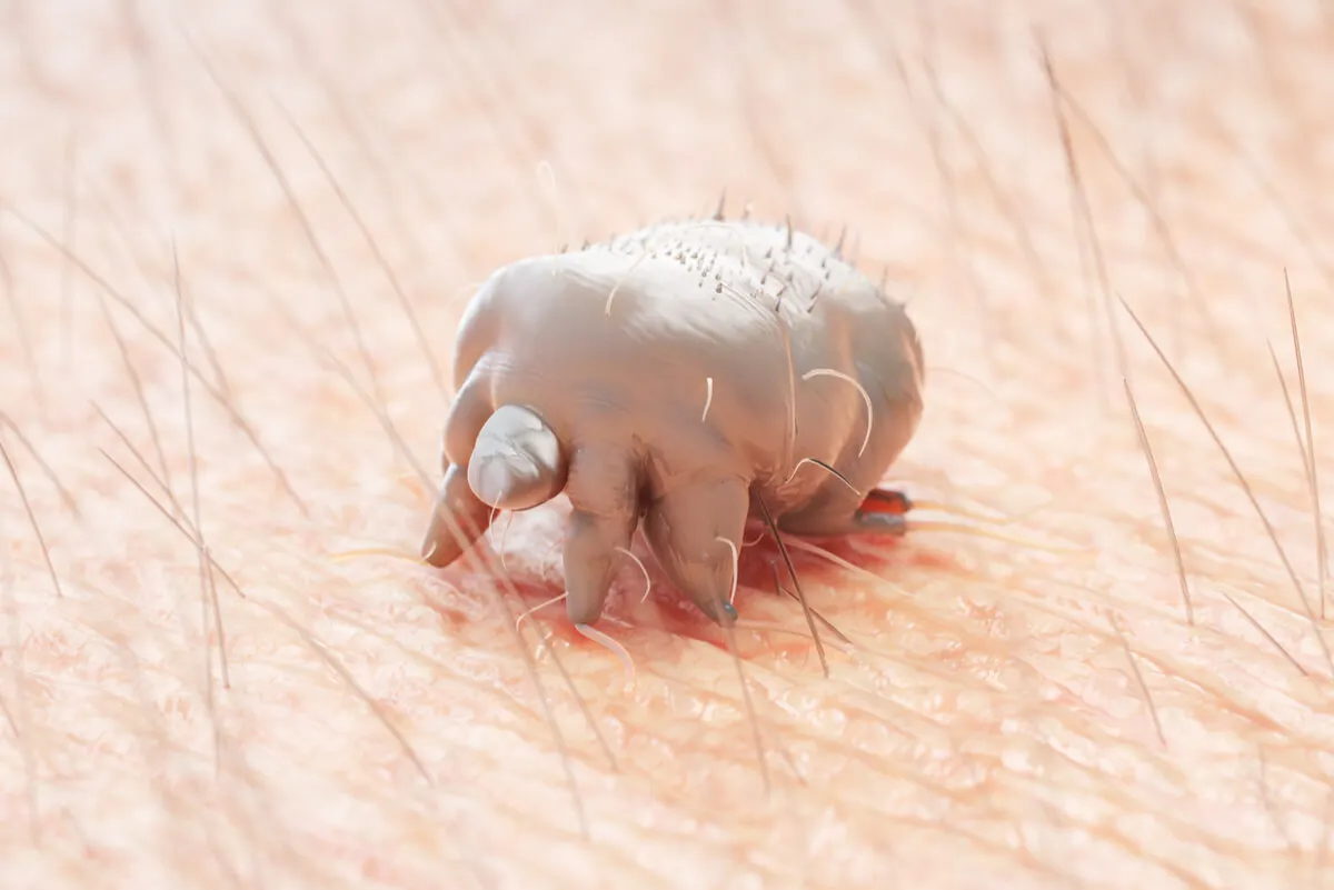 Sarcoptes scabiei en la piel.