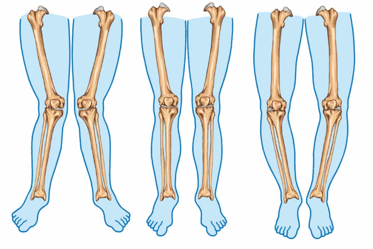 Tipos de piernas.