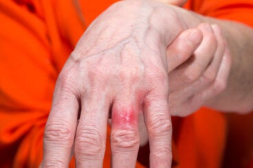 Alergia al níquel: causas, síntomas y precaución