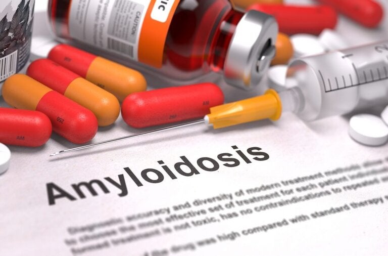 Amiloidosis: síntomas, tratamiento y pronóstico