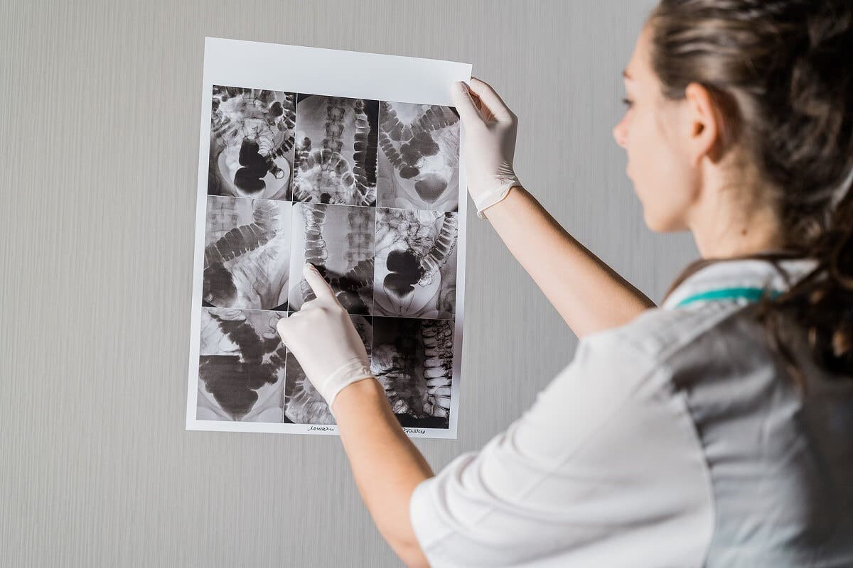 Radiografía del intestino