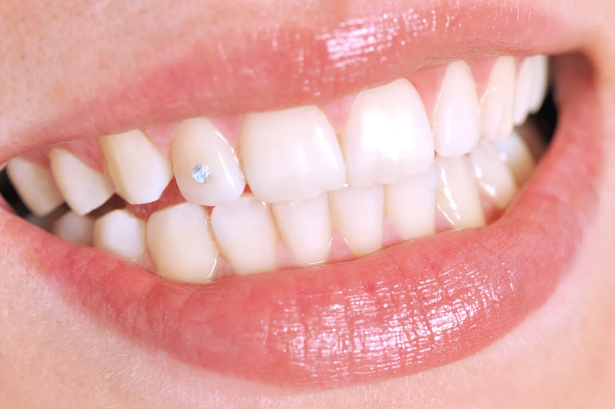 Perçage des dents.