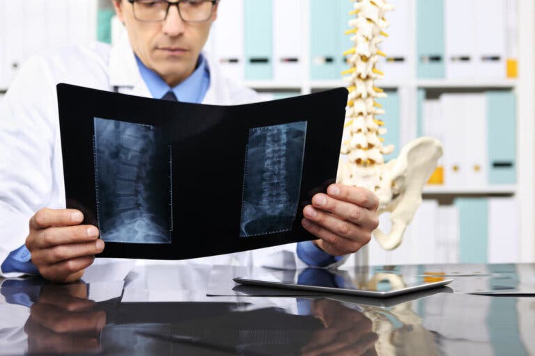 Laminectomía: ¿en qué consiste y cuáles son sus riesgos?