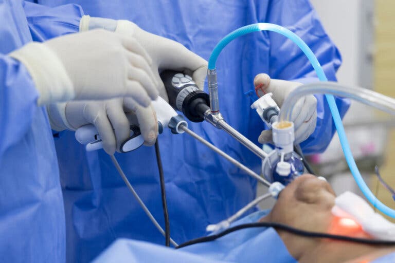 Tiroidectomía: proceso, motivos y recuperación