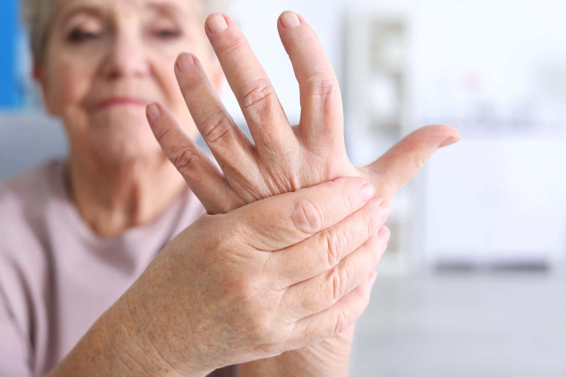 A woman with arthritis.