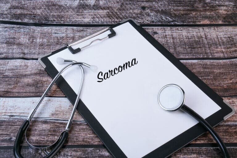 Sarcoma de Kaposi: origen, síntomas y tratamiento