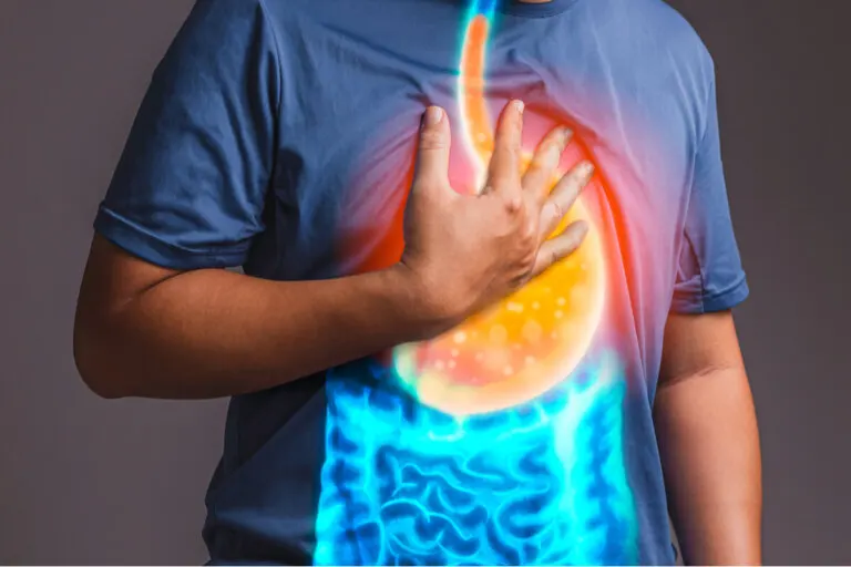 Reflujo gastroesofágico: ¿cómo calmar sus síntomas con cambios en la dieta?