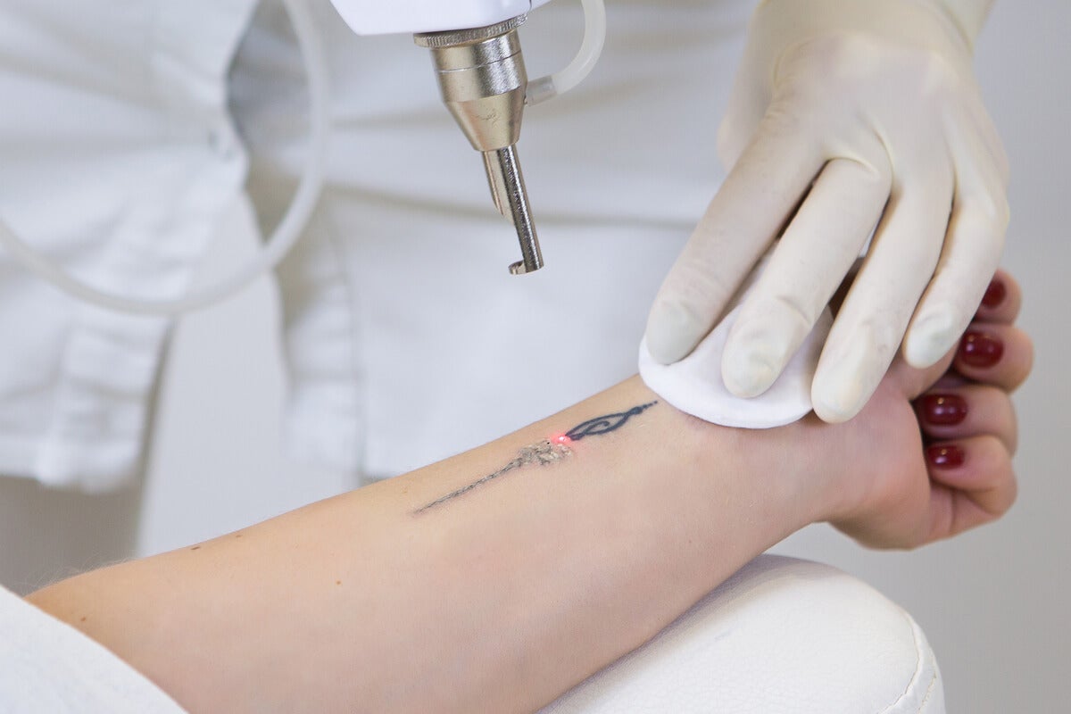 Restos de tinta de los tatuajes pueden terminar en los ganglios linfáticos, muestran estudios