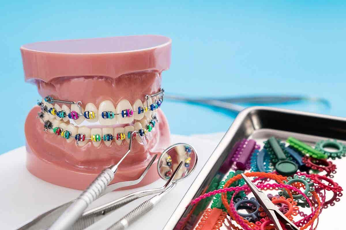 ¿Qué hace un ortodoncista?