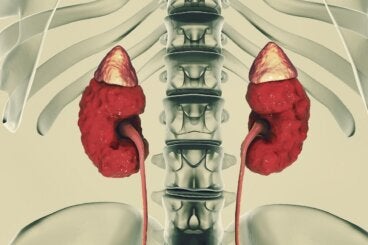 ¿Qué es la enfermedad renal poliquística? Síntomas y tratamiento
