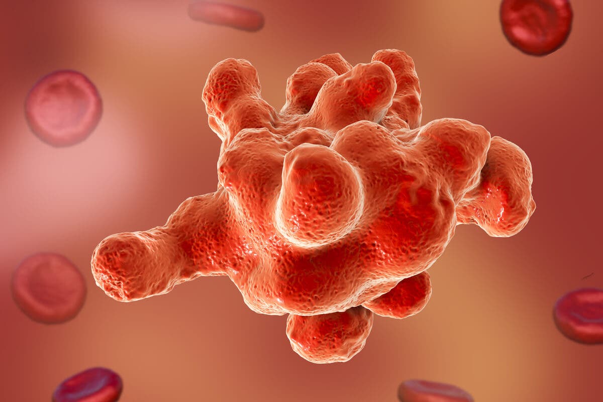Entamoeba hystolitica causa amebiasis.