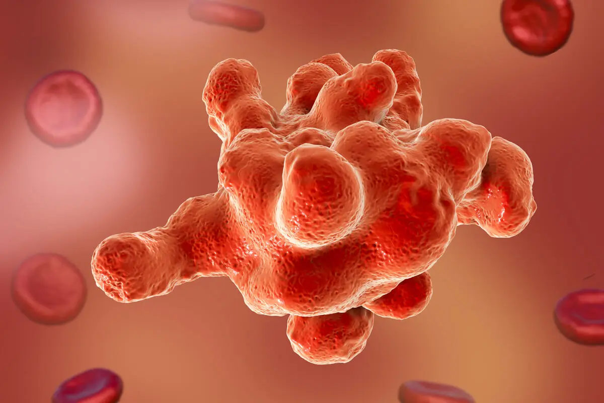 Entamoeba hystolitica causa amebiasis.