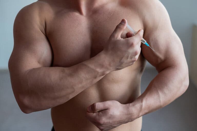 Palumboismo: efecto del exceso de esteroides en fisiculturistas