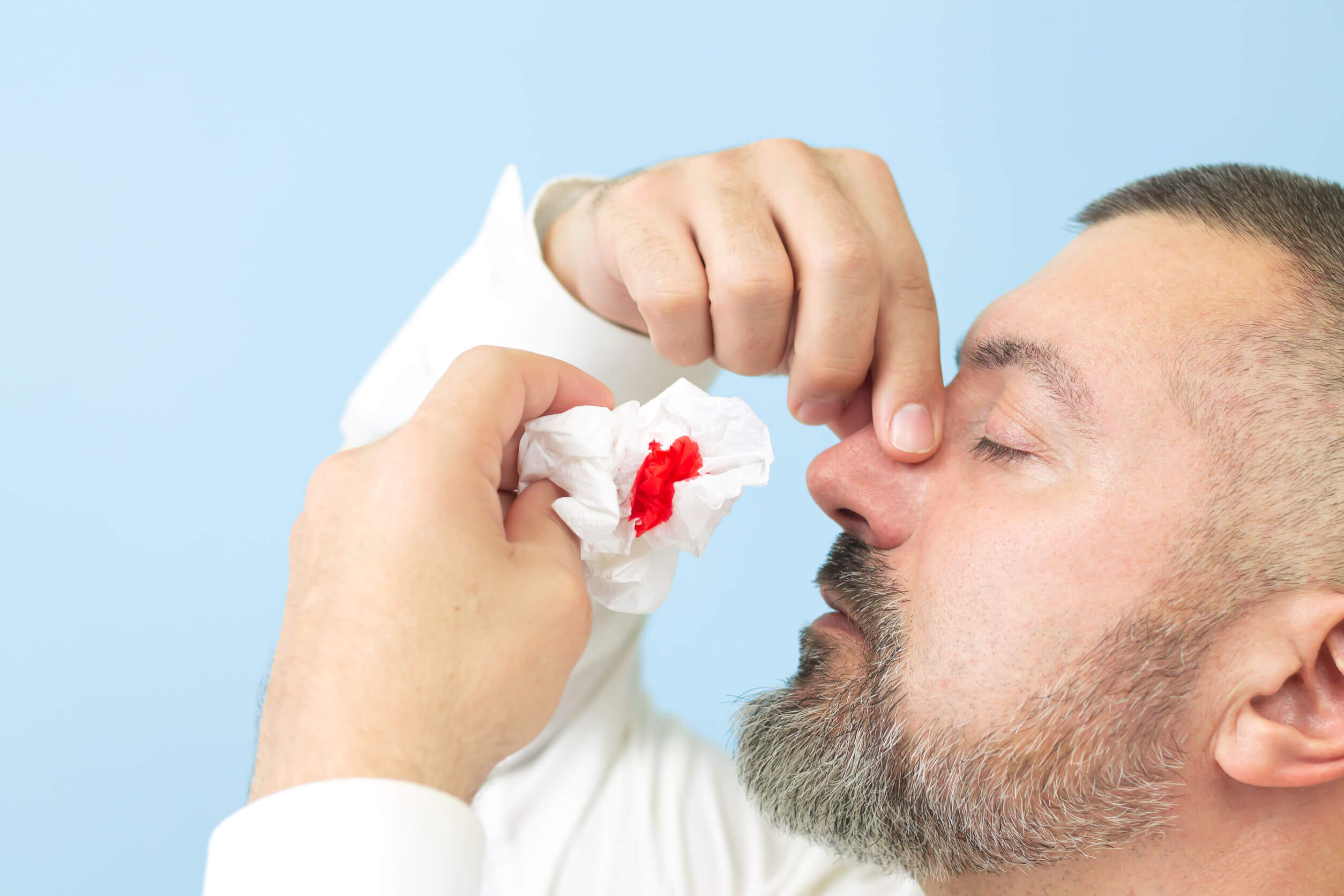 Cómo detener el sangrado nasal con 6 remedios naturales