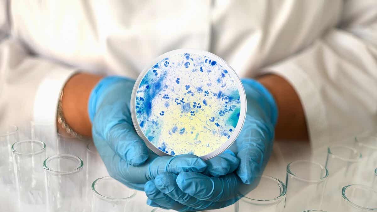Candidiasis intestinal causas, síntomas y tratamiento Mejor con Salud