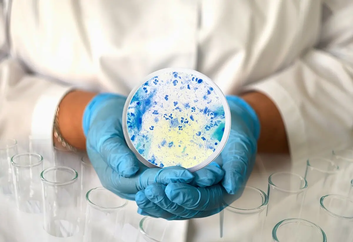 Generalidades sobre Candida
