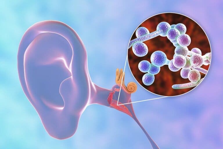 Otomicosis: ¿qué es y qué la causa?