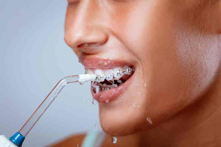 ¿Qué son los irrigadores dentales?