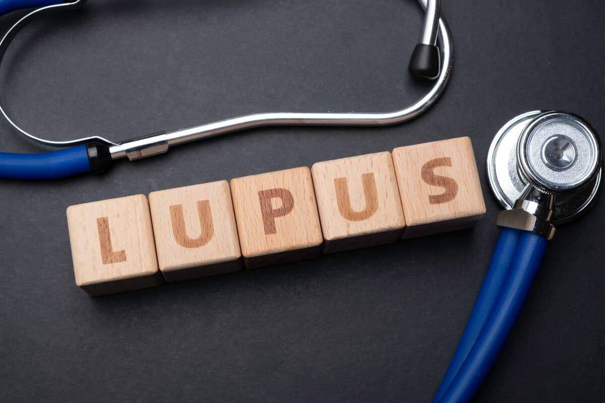 Lupus.