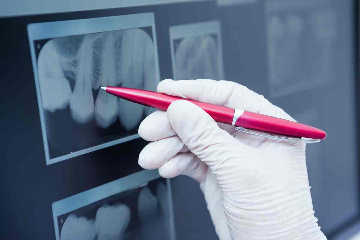 Radiographie dentaire et orthopantomographie.