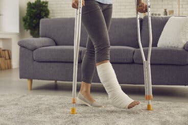 Yeso vs fibra de vidrio: ¿cuál es mejor para las fracturas?