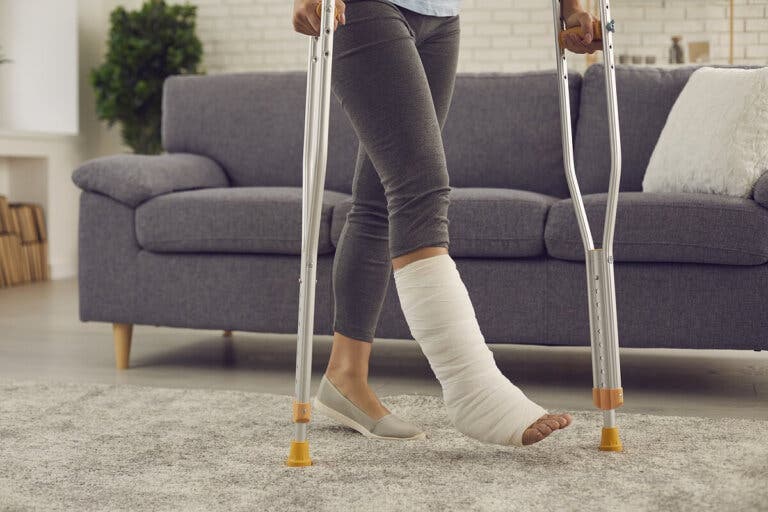 Yeso vs fibra de vidrio: ¿cuál es mejor para las fracturas?