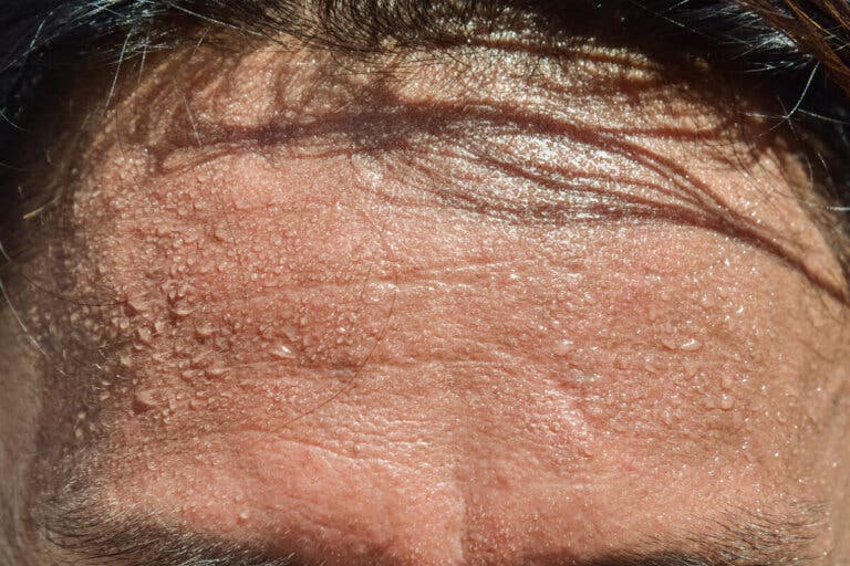 5 consejos para evitar el exceso de sudor en la cabeza