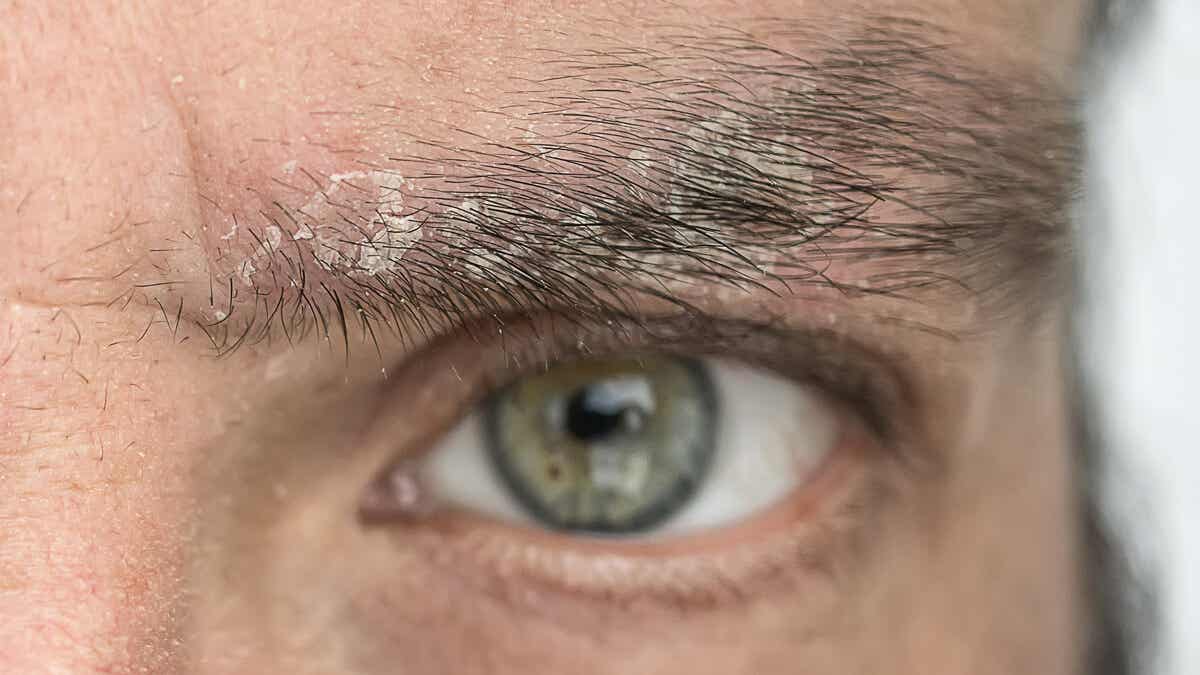 Beule am Kopf: 6 mögliche Ursachen - Besser Gesund Leben