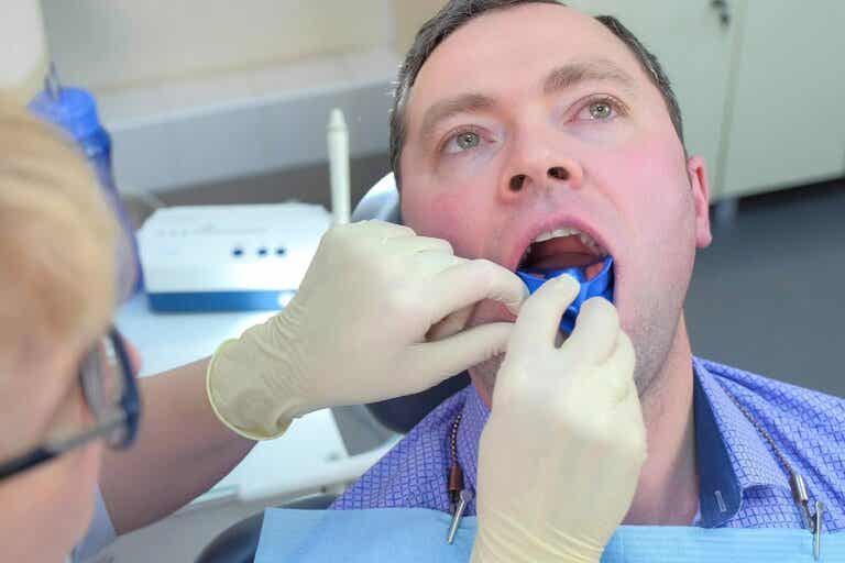 Flúor dental: ¿cómo ayuda a prevenir las caries?
